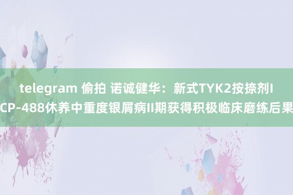 telegram 偷拍 诺诚健华：新式TYK2按捺剂ICP-488休养中重度银屑病II期获得积极临床磨练后果